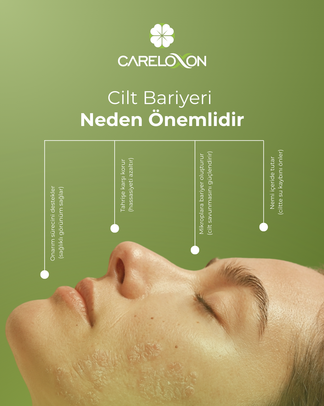 Kortizonsuz Yaşam: Sedef Bakımında Neden Uzun Vadeli Stratejiler Kurmalıyız?