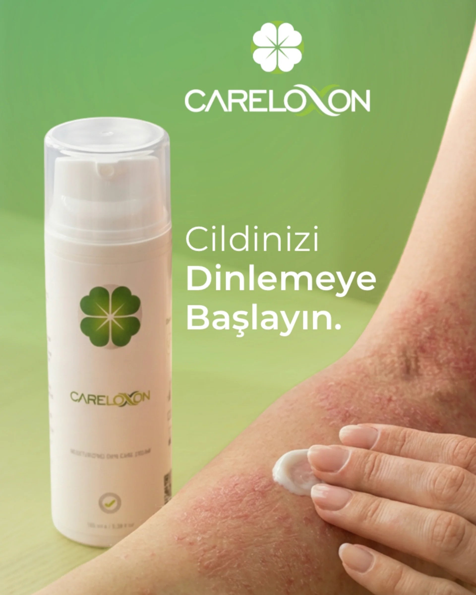 Sedef Eğilimli Ciltlerde Bariyer Onarımının Bilimi