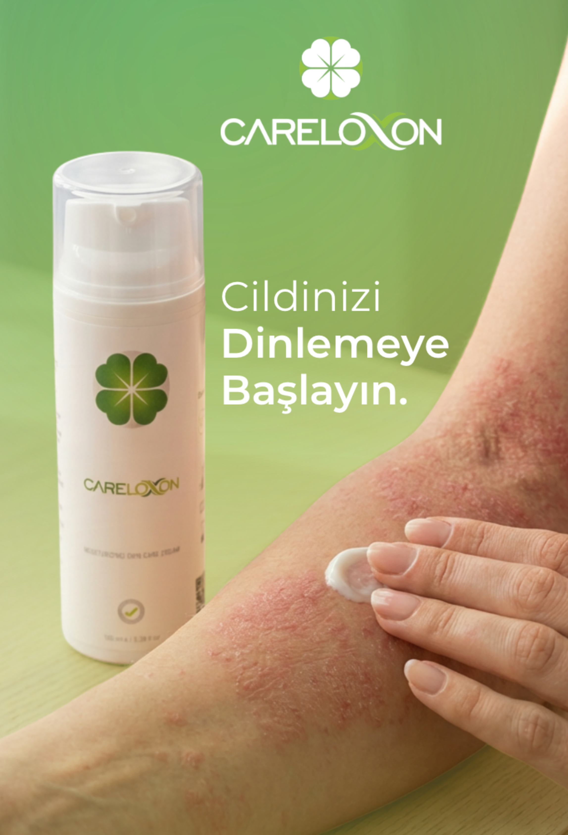 Sedefe ve Egzamaya Eğilimli Ciltler için Cilt Bakım Kremi