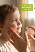 Sedefe ve Egzamaya Eğilimli Ciltler için Cilt Bakım Kremi
